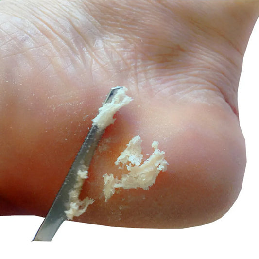 1pc professional tool foot scraper stainless steel foot care pedicure
